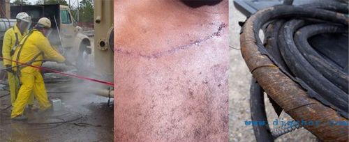 高壓清洗機工作中應(yīng)注意的安全問題